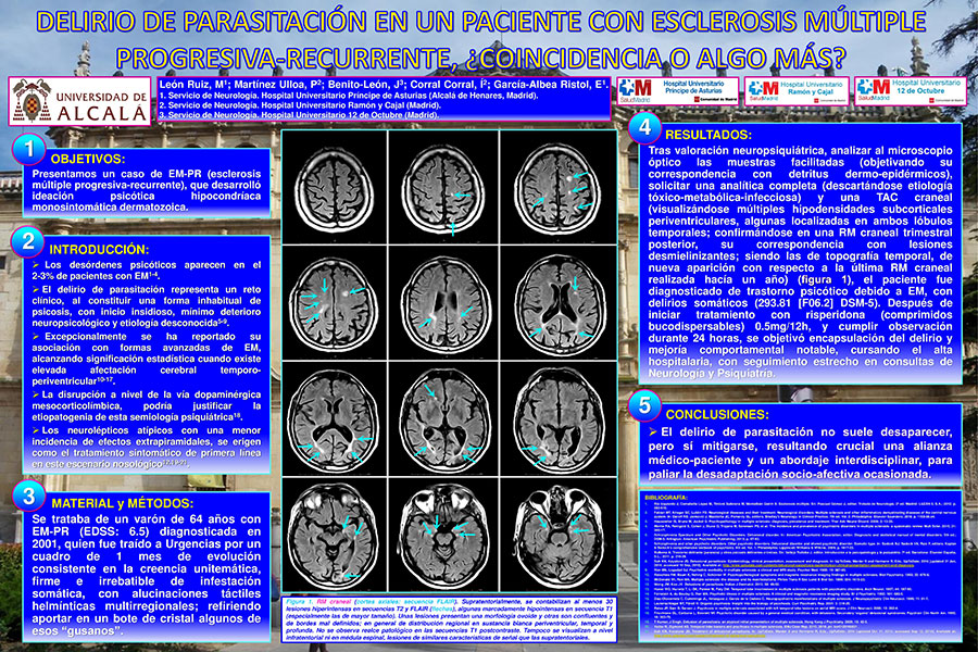 Póster 1 Clínica San Vicente 1 Reunión SEN